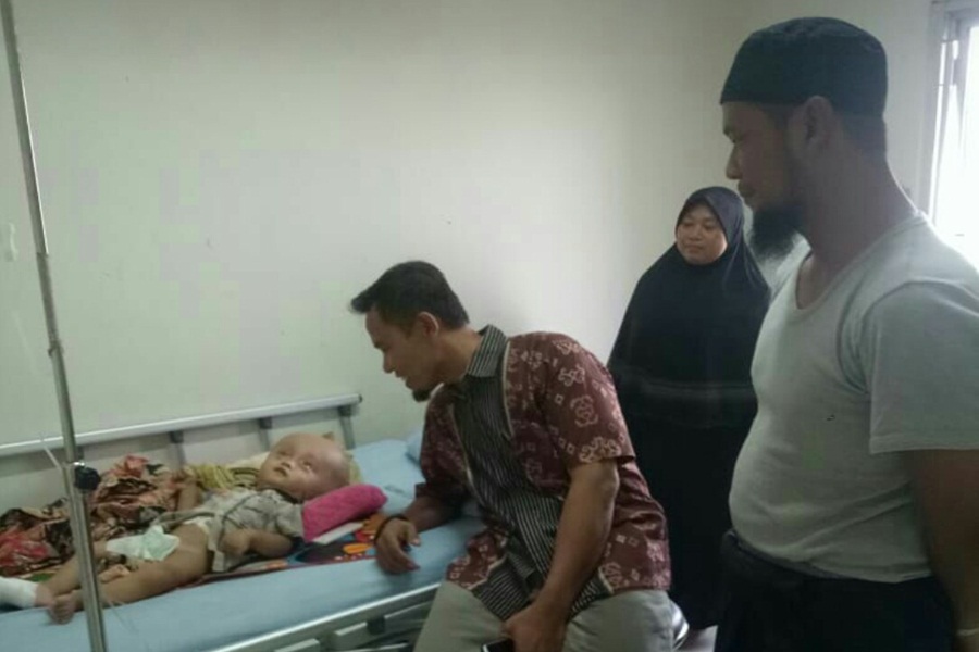 Bayi Hidrosefalus Dirawat di RSUD Banten
